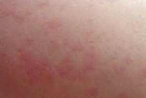 ݡ֢״